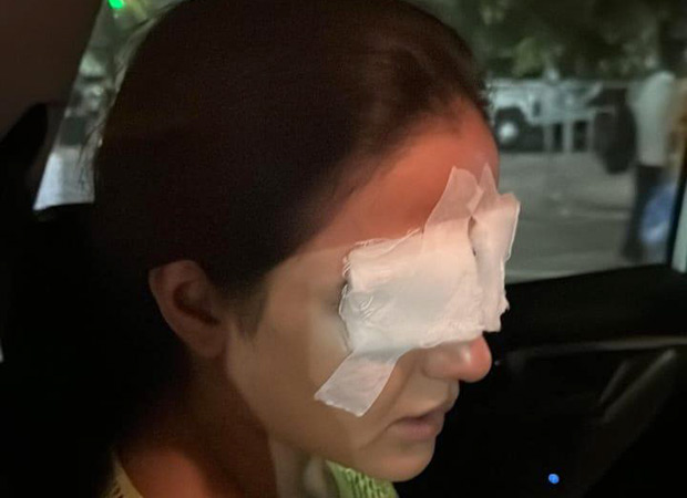 Jasmin Bhasin battles corneal damage after lens mishap, leaves her in pain : Bollywood News Jasmin Bhasin battles corneal damage after lens mishap, leaves her in pain : Bollywood News